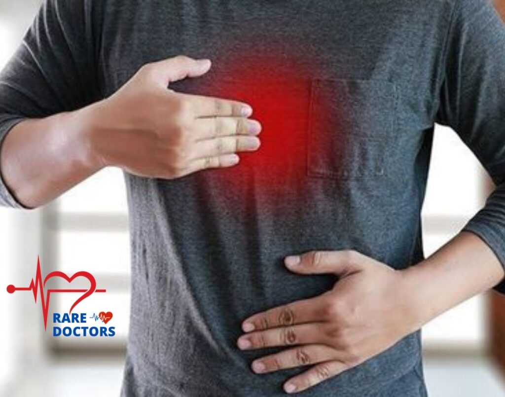 داء الجزر المعدي المريئي rare doctors