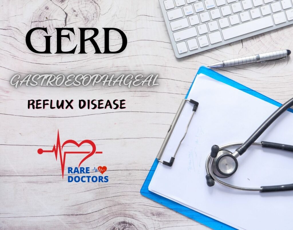 داء الجزر المعدي المريئي rare doctors